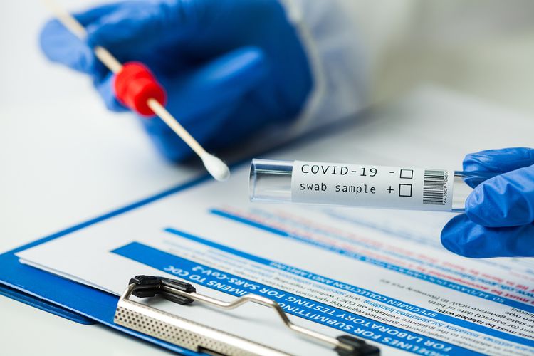 Pemerintah Hapus Syarat Tes Antigen dan PCR bagi Pelaku Perjalanan dalam Negeri