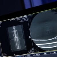 Prabowo Buat Program Medical Check Up Gratis Tahun 2025